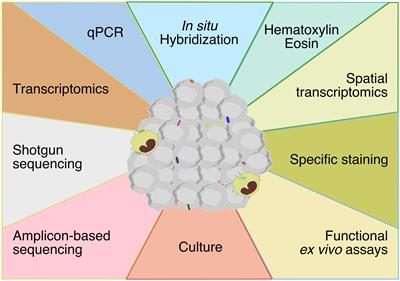 Could the tumor-associated microbiota be the new multi-faceted player in the tumor microenvironment?